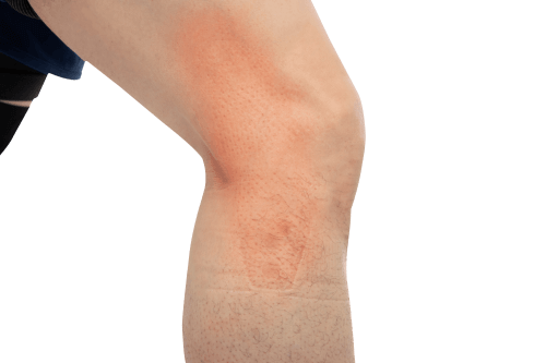 knee1500