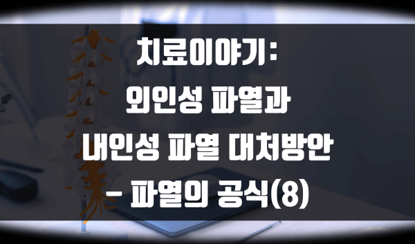 외인성 파열과 내인성 파열 대처방안 – 파열의 공식(8)