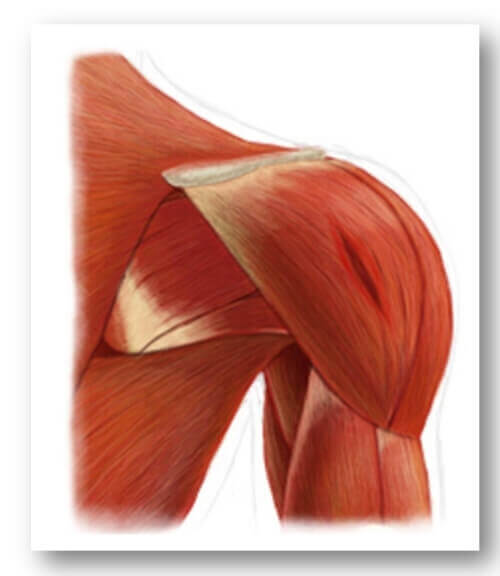 활동과 부상 이유 - 어깨 근육 파열