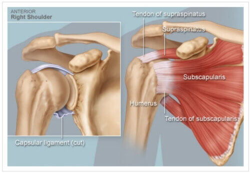 관절 부상의 이유 - 하얀 색 부분이 힘줄(회전근개)