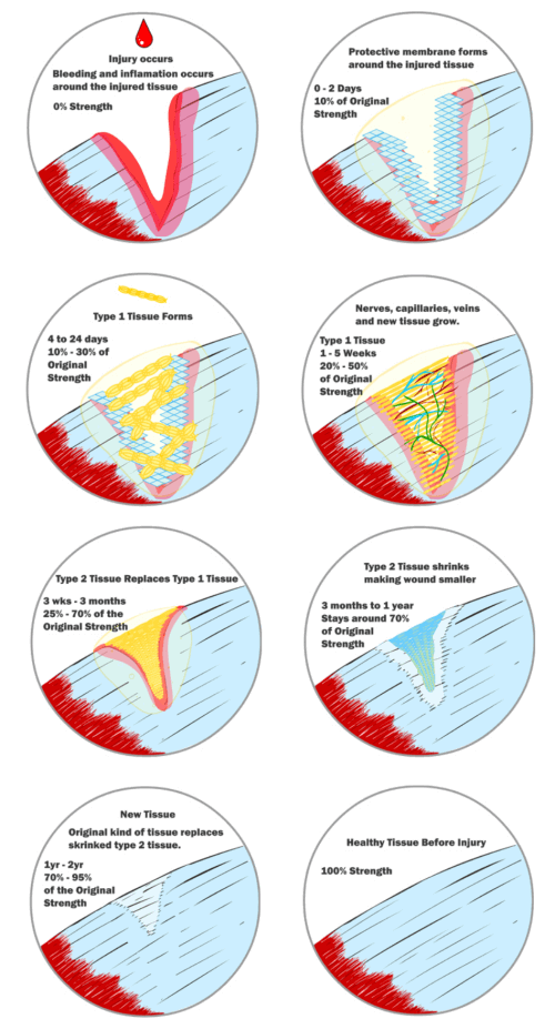 관절 부상 치유 방법 : 힘줄의 재생 과정