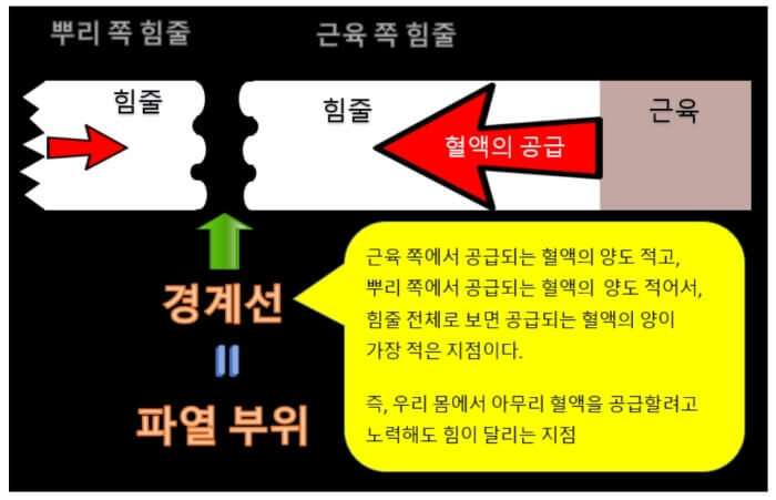 안쪽 근육의 허상과 인대 힘줄 단련 방법 : 힘줄에서도 파열되는 부위는 따로 있다