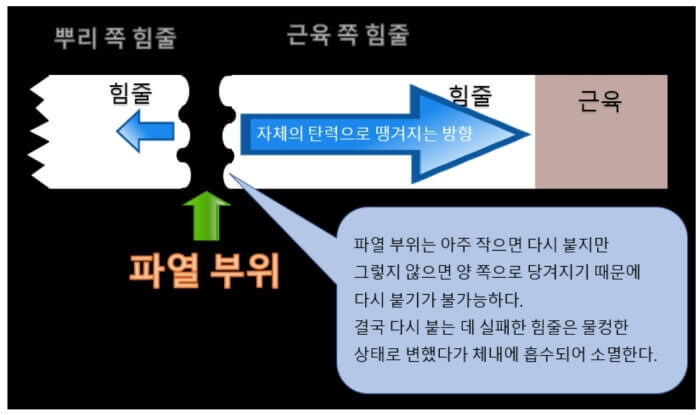 안쪽 근육의 허상과 인대 힘줄 단련 방법 : 힘줄 파열 후 탄성에 의해 땡겨진다