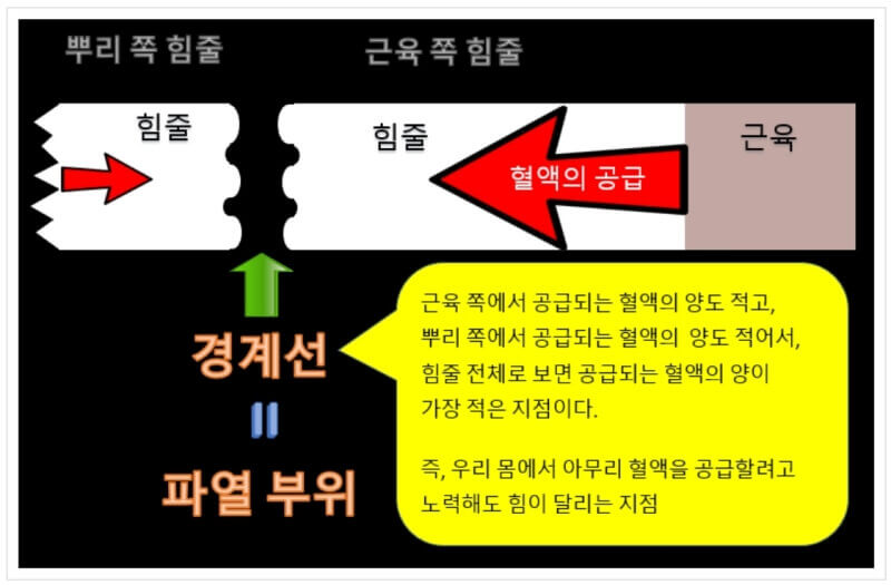 외인성 파열과 내인성 파열 대처방안 : 파열의 공식이 적용되는 부위